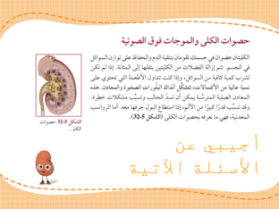 1حصوات الكلى by Heba Adel
