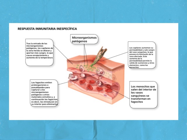 Sistema Inmunitario  by Ruth Sanchez Fernandez