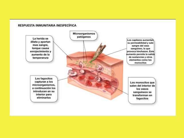 Partes Del Sistema Inmunitario by Miriam Majolero Martinez