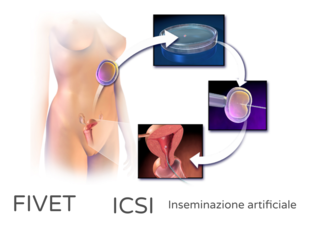 PMA by Alessandro Pizzo